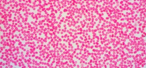 Микроскоп цифровой Levenhuk D670T, 5,1 Мпикс, тринокулярный, изображение 12